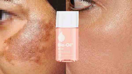 Bio oil