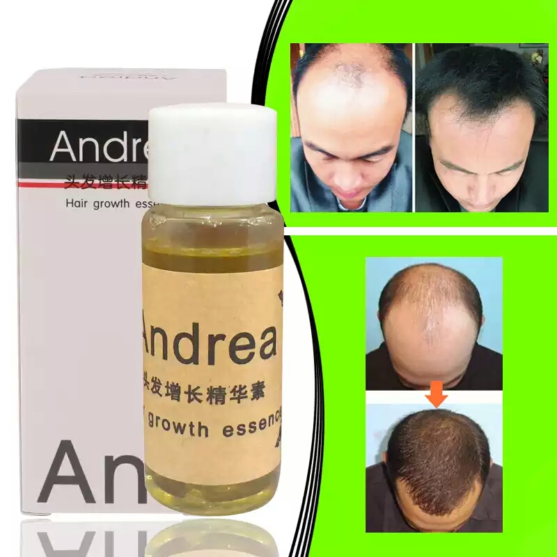 produits pour pousser vos cheveux